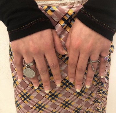 Bracelet / Ring - © D'heygere